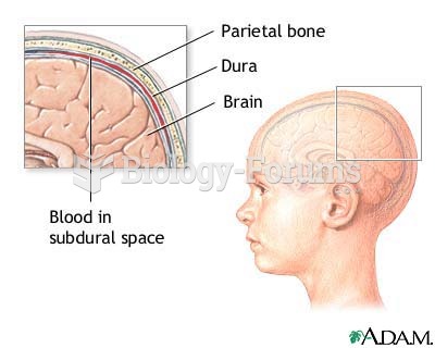 layers of the skull to memorize for intracranial questions