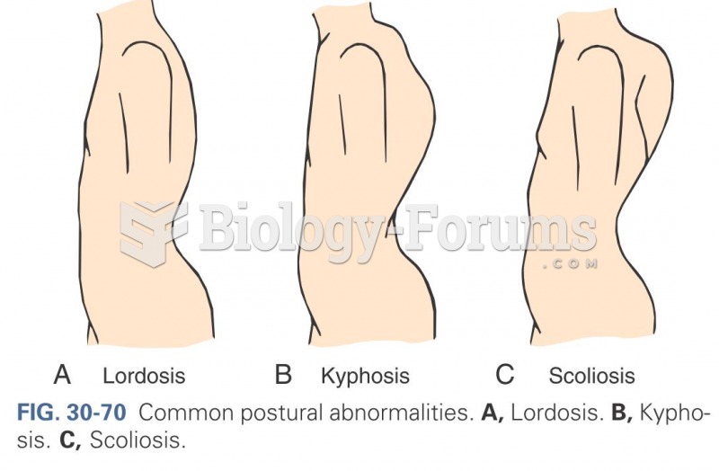 Common postural abnormalities
