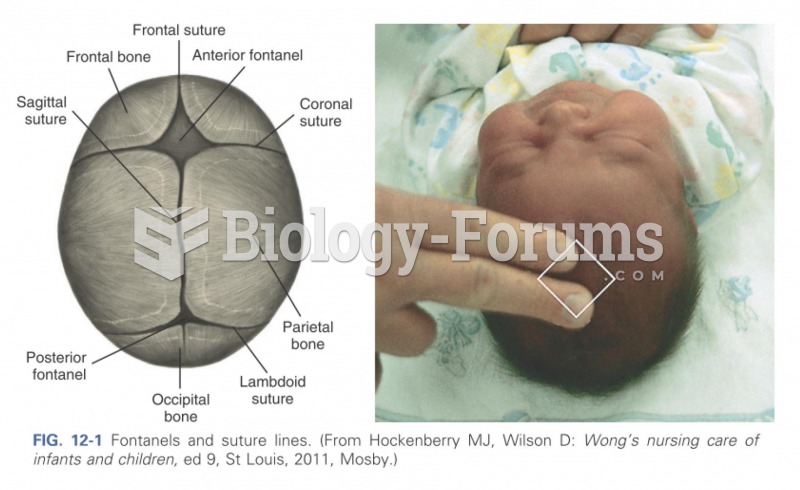 Fontanels and suture lines