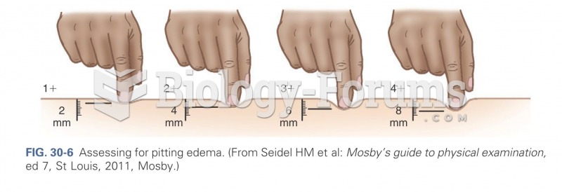 Assessing for pit edema