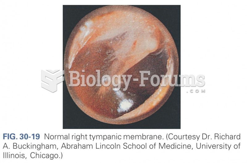 Normal right tympanic membrane