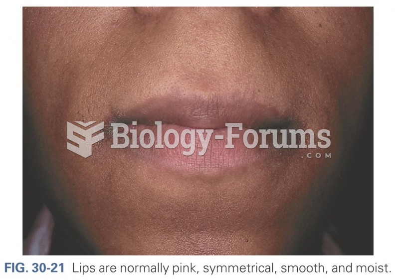 Lips are normally pink, symmetrical, moist and smooth