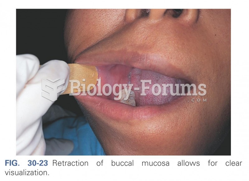 Retraction of buccal mucosa allows for clear vocalization
