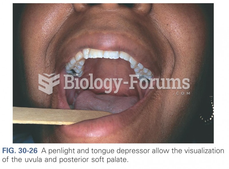 A penlight and tongue depressor allow the visualization fo the uvula