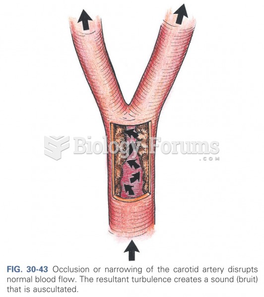 Occlusion or narrowing of the carotid artery disrupts blood flow