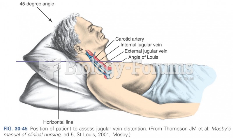 Position of patient to assess jugular vein distention