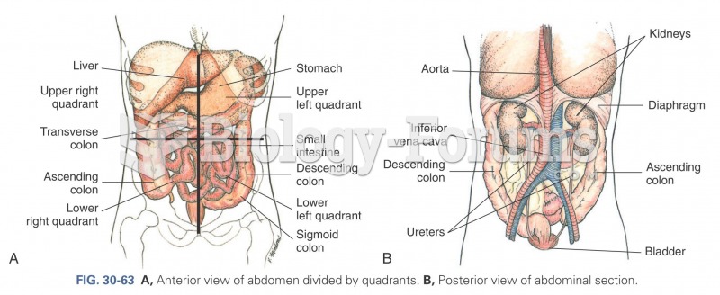 Anterior view of abdomen divided by quadrants