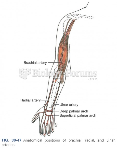 Anatomical positions of brachial, radial, ulnar arteries