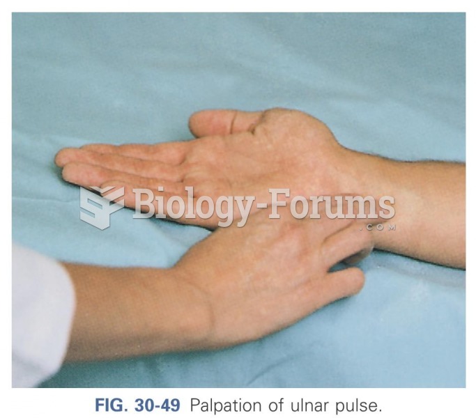Palpation of ulnar pulse