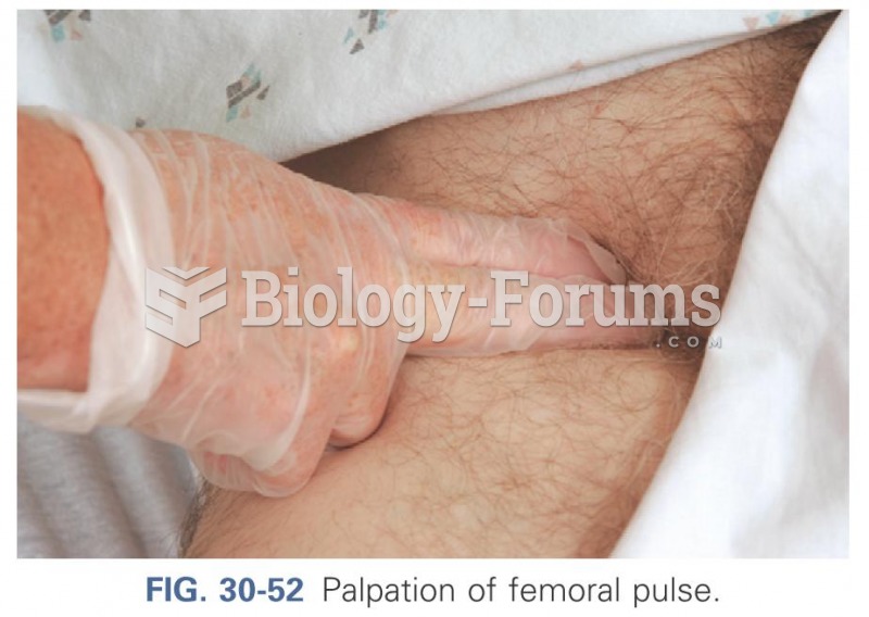 Palpation of femoral pulse