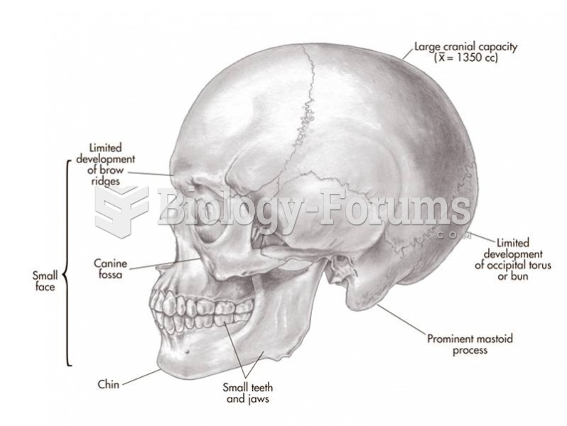 Features of the skull of anatomically modern Homo sapiens.