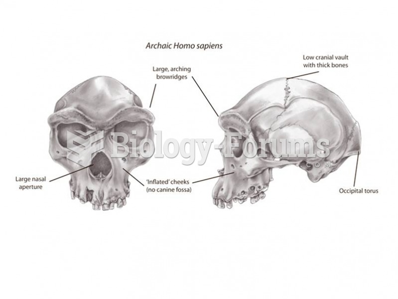 Features of the skull of archaic Homo sapiens.  