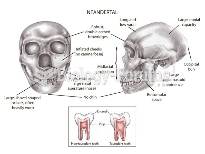 The Neandertal skull and teeth.  