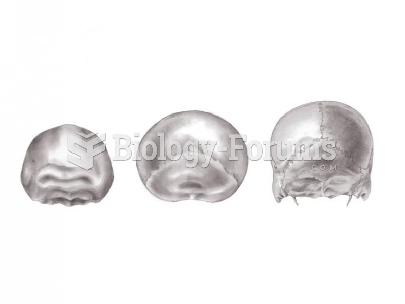 Posterior views of H. erectus, Neandertal, and modern H. sapiens show differences in vault shape. 