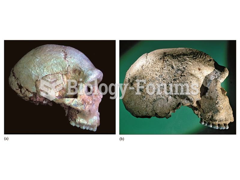 (a) The Petralona cranium from Greece. (b) The Steinheim cranium from Germany. 