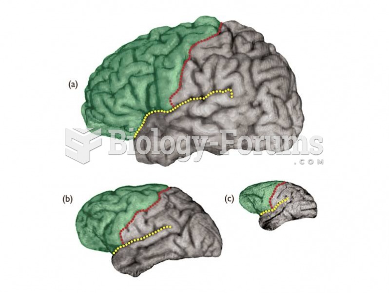 The frontal lobe (green) bounded by the Sylvian fissure (yellow line) and central sulcus (red line),