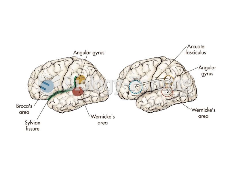 The major language areas of the left hemisphere of the brain. 