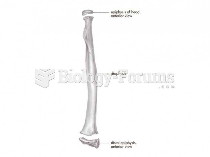 Long bones develop from several bony centers--one for the shaft and at least one for each end. The e