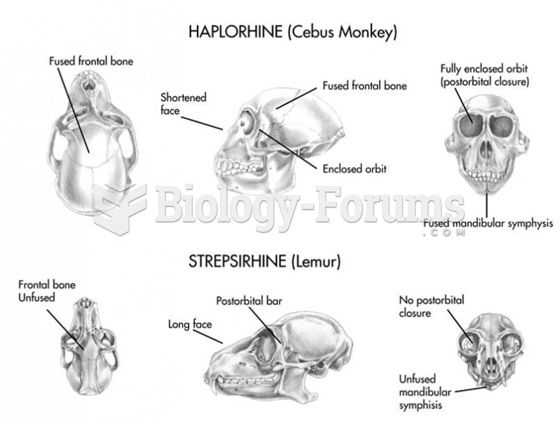 The skulls of living haplorhines differ from those of strepsirhines by having large brains, an enclo