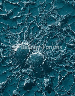Bacterial cells of Staphylococcus aureus