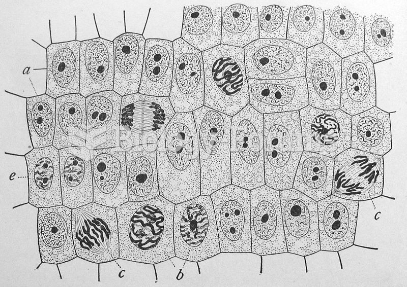 Allium cells in different phases of the cell cycle