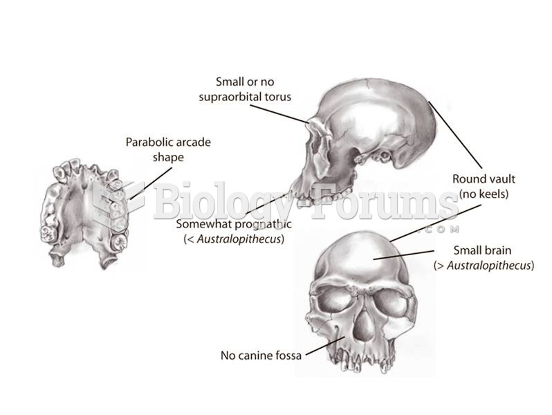 Key anatomical features of Homo habilis include reduced facial size, a parabolic palate, and some br