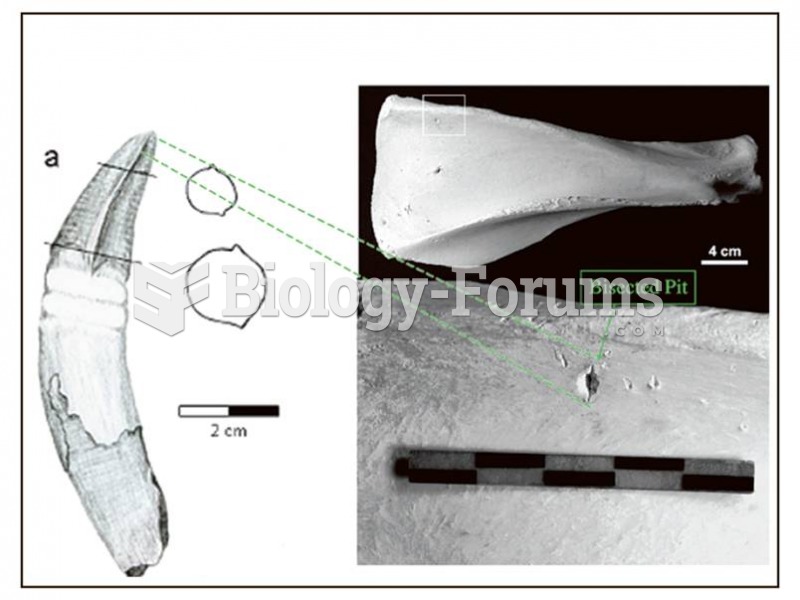 Crocodiles leave distinctive bite marks that reflect the shape of their teach. 