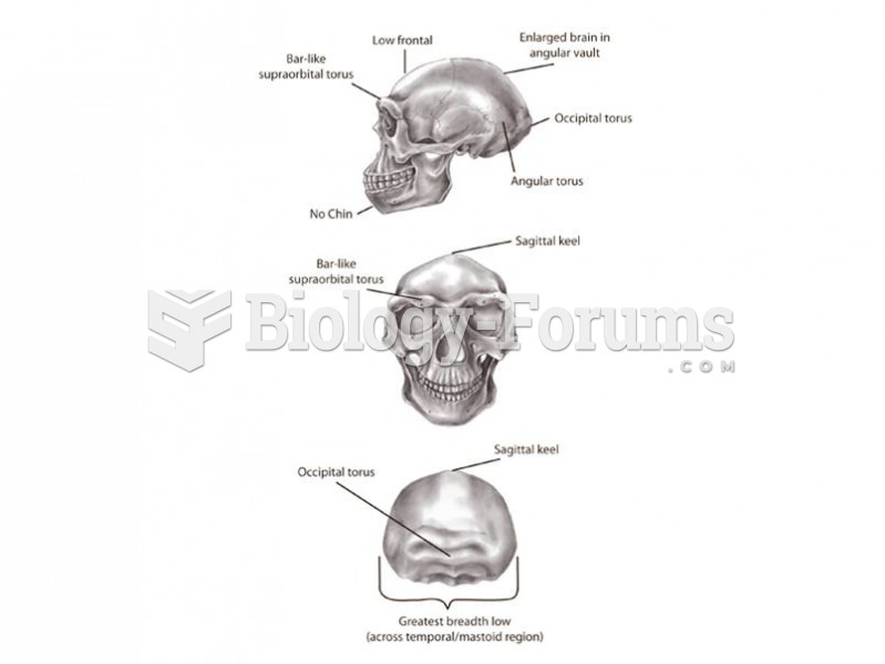 Major features of Homo erectus include increased brain size, an angular vault, and cranial superstru
