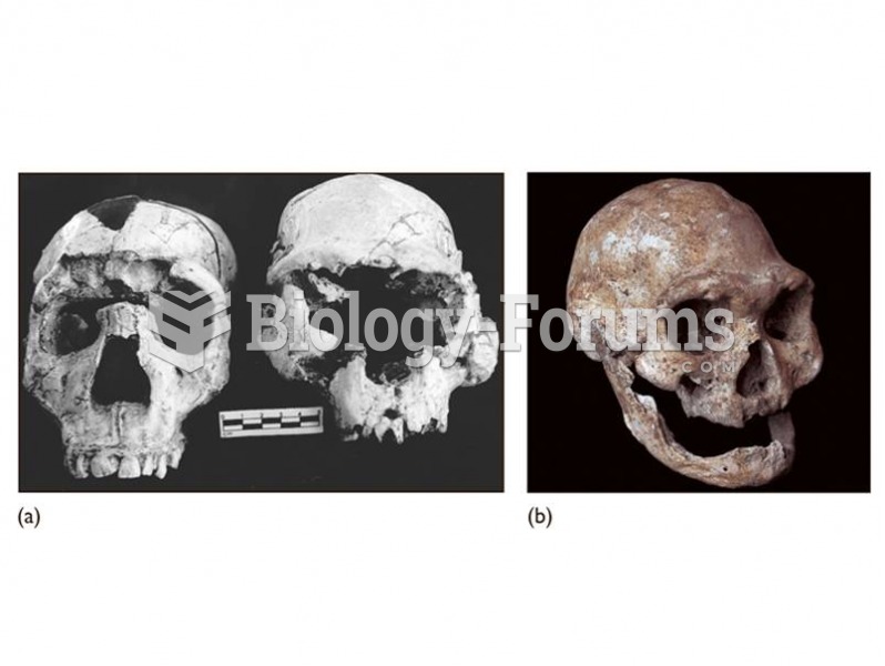 (a) The Dmanisi cranium (right) shows similarities to early African H. erectus including the Narioko