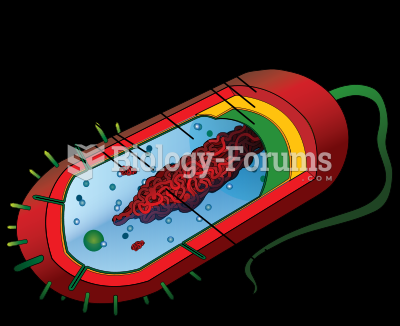 Diagram of a typical prokaryotic cell