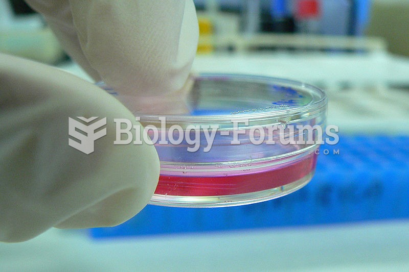 Cell culture in a Petri dish