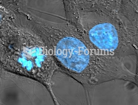Cultured HeLa cells have been stained with Hoechst turning their nuclei blue