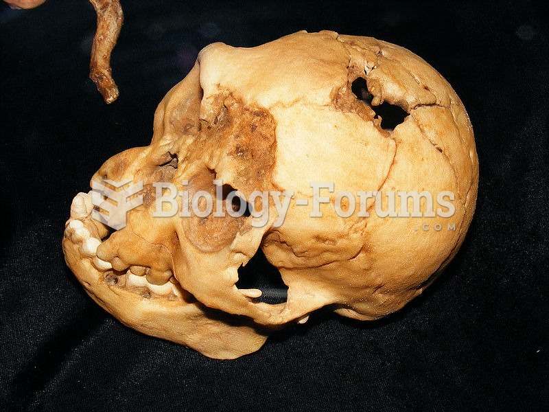 Top view of a cast of the LB1 skull