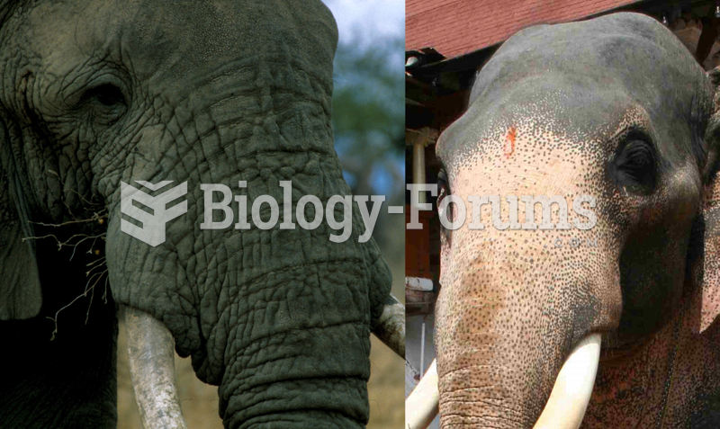 Skin of an African (left) and Asian (right) elephant.