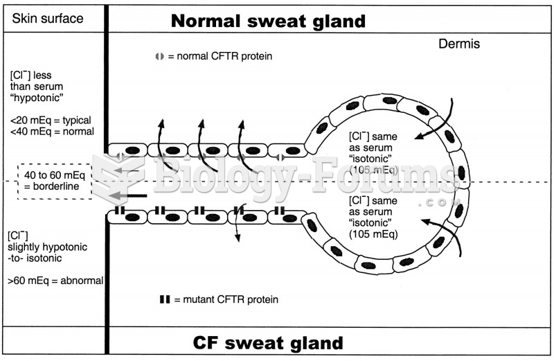 Cystic fibrosis sweat glands