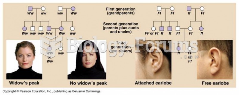 Genetics of Widow's Peak