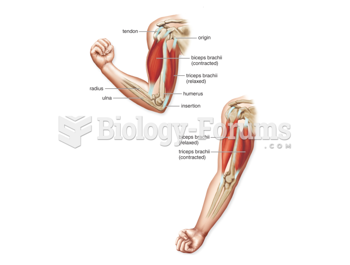 Antagonistic Muscles