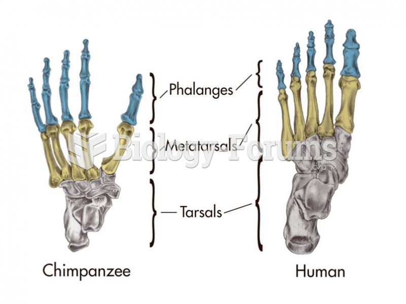 The biped’s foot bears more weight than the quadruped’s and so the bones are stouter. 
