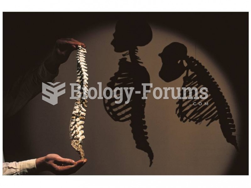 Reconstructed Australopithecus afarensis spine shows that species walked upright. 