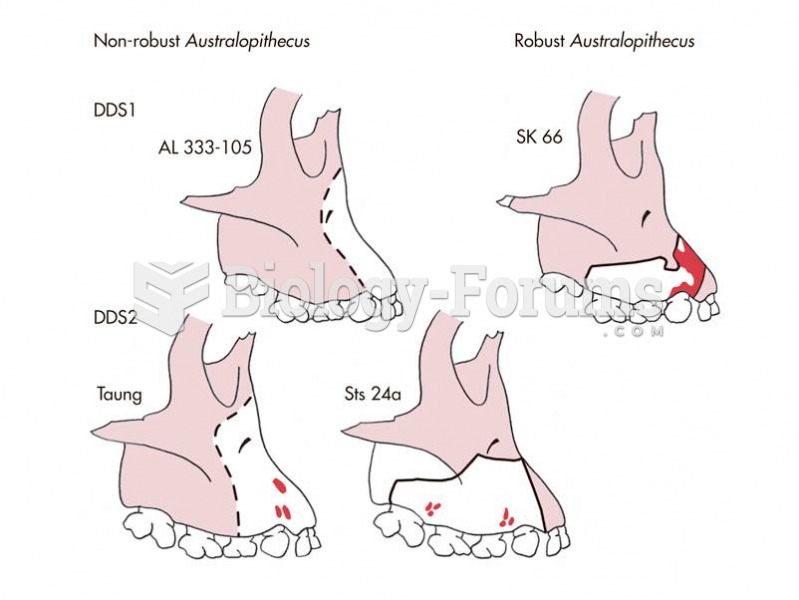 Comparing fossil patterns of the Hadar Baby, the Taung Child, and Au. Robustus.