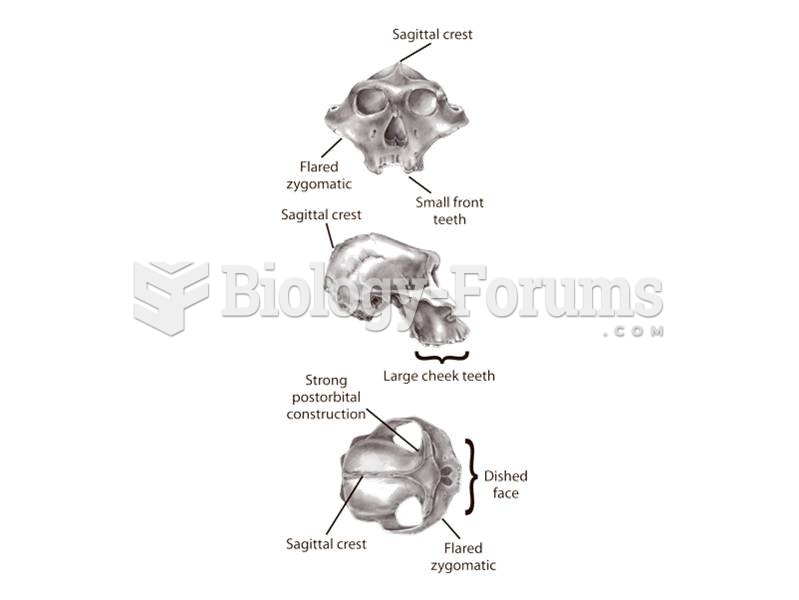 Key features of robust australopithecines.  