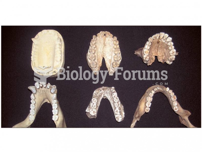 Comparing the jaws of chimpanzees, australopithecines, and humans. 