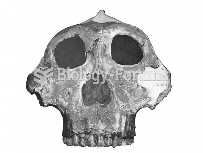 Olduvai Hominin 5 (OH 5) is a hyper-robust member of Australopithecus boisei.