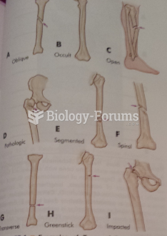 Bone Fracture Types