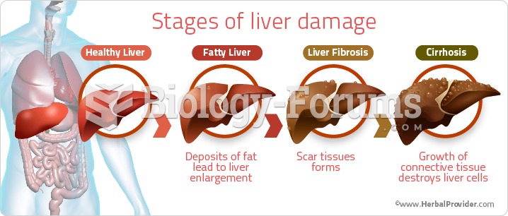 Stages of Liver Damage 2