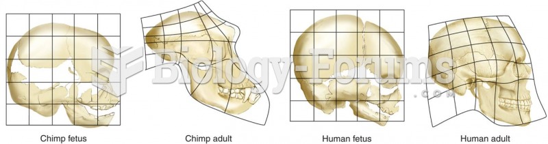 Neoteny in Evolution of the Human Skull