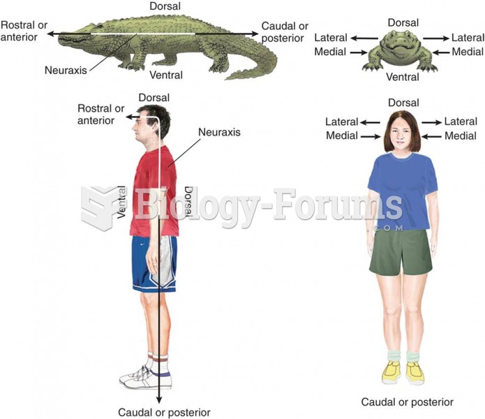 Views of Alligator and Human  