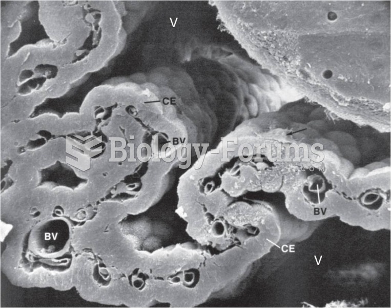 A Scanning Electron Micrograph of the Choroid Plexus