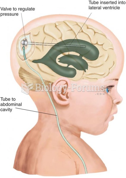 Hydrocephalus in an Infant 