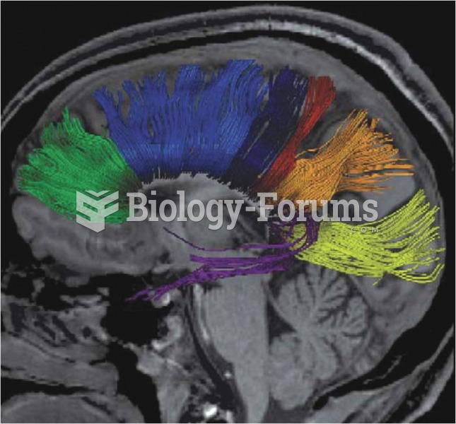 Bundles of Axons in the Corpus Callosum 